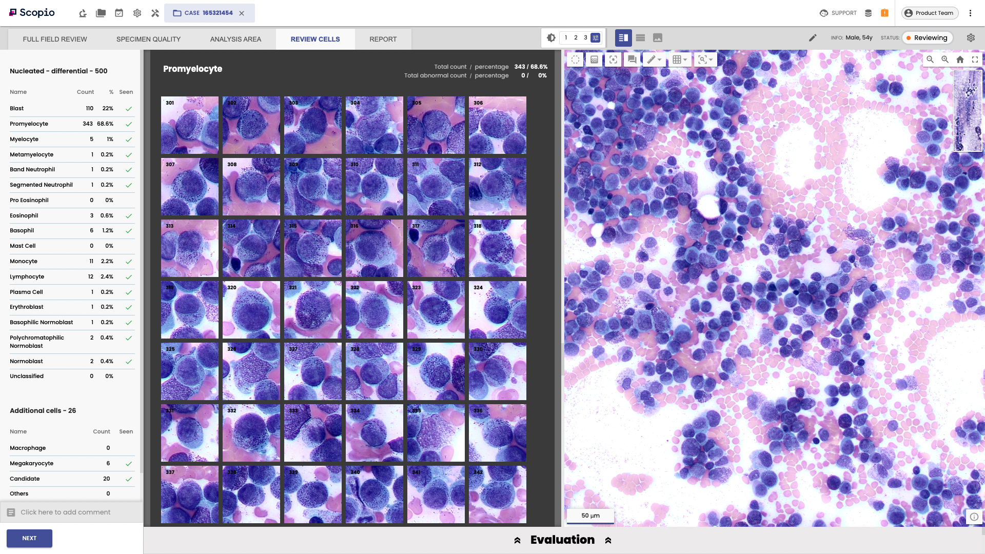 Scopio's full-field bone marrow aspirate application