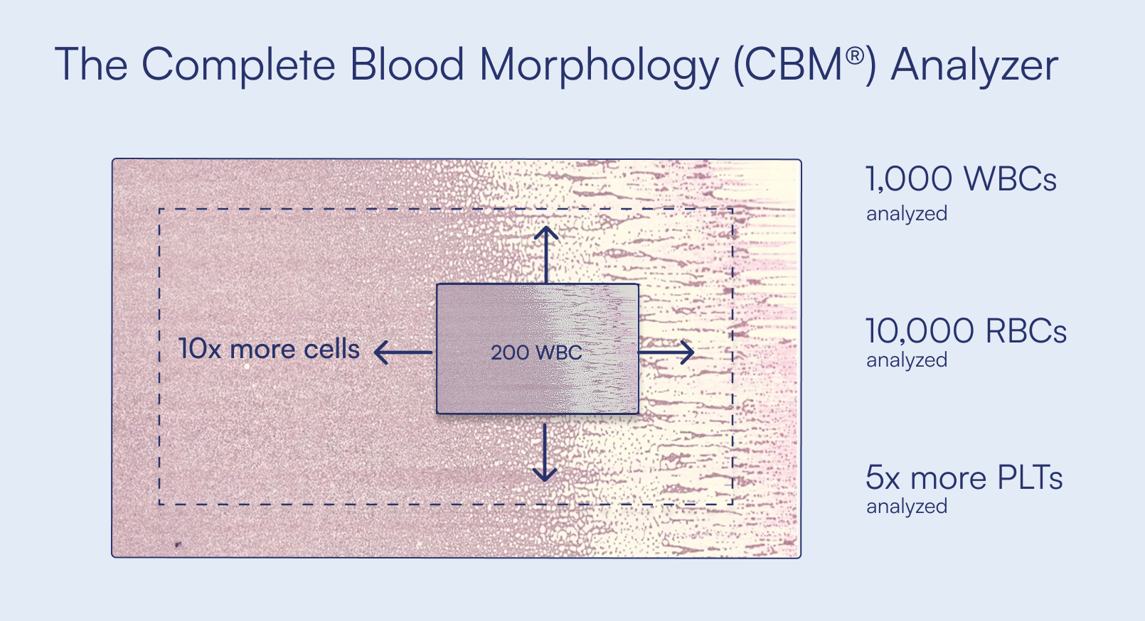 Diagram showing the Scopio CBM Analyzer examining 1,000 white blood cells, 10,000 red blood cells and five times more platelets across a full-field blood smear, approximately ten times more cells than a 200-cell differential.