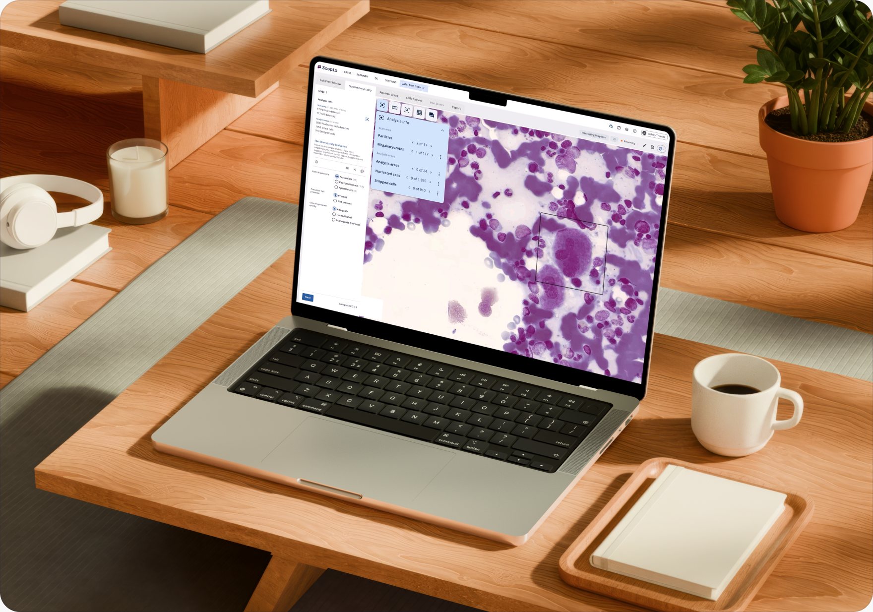 The Scopio application open on a laptop on a desk