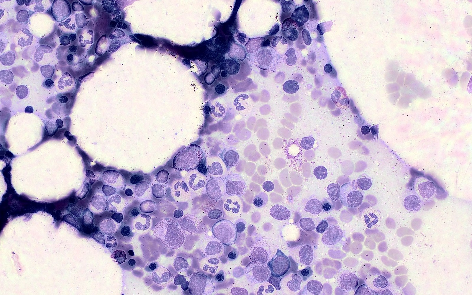 Full-Field view of a bone marrow aspirate scanned by Scopio